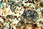 Lichens II