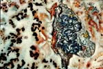 Lichens I